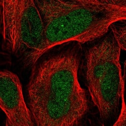 RDH14 Antibody, Novus Biologicals 0.1mL; Unlabeled:Antibodies, Polyclonal